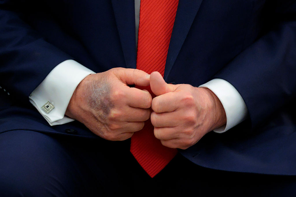Trump hand